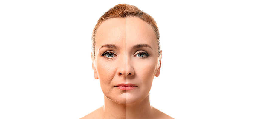 rejuvenescimento-facial-14082017162533